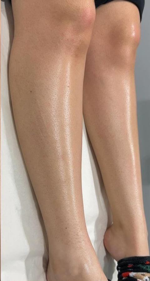 Waxing Beine – nachher