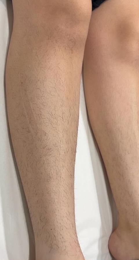 Waxing Beine – vorher